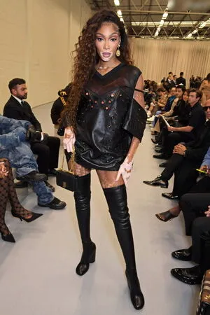Winnie Harlow OnlyFans Leaked Free Thumbnail Picture - #3Mbz4SkrCz