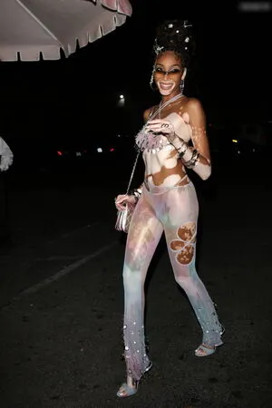 Winnie Harlow OnlyFans Leaked Free Thumbnail Picture - #3kAaiFZNta