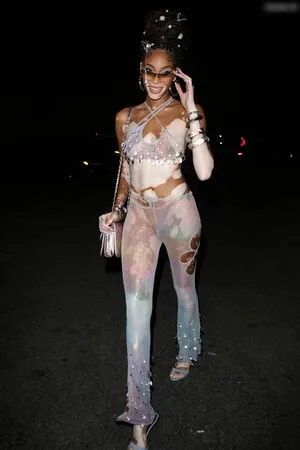 Winnie Harlow OnlyFans Leaked Free Thumbnail Picture - #3ocgo4HrqN