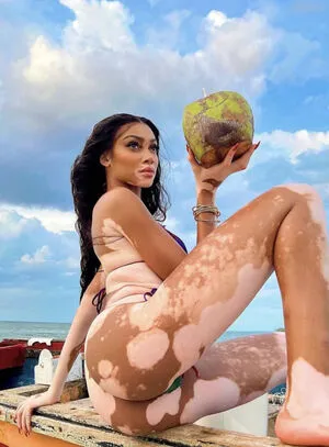 Winnie Harlow OnlyFans Leaked Free Thumbnail Picture - #43nqPqja8t