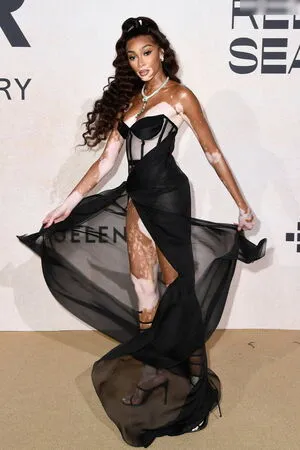 Winnie Harlow OnlyFans Leaked Free Thumbnail Picture - #45PwCBcMkH