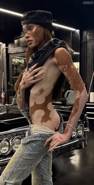 Winnie Harlow OnlyFans Leaked Free Thumbnail Picture - #4J15QfYUWu