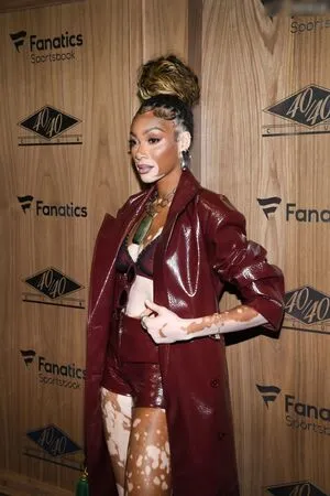 Winnie Harlow OnlyFans Leaked Free Thumbnail Picture - #4K66yqxn4f