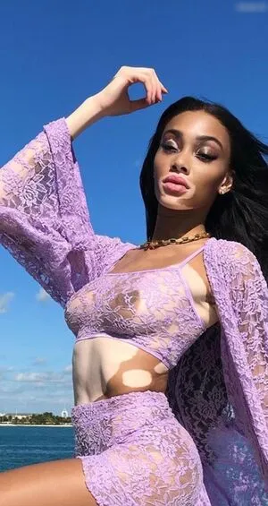 Winnie Harlow OnlyFans Leaked Free Thumbnail Picture - #4bB9lHSjx0