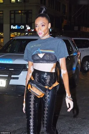 Winnie Harlow OnlyFans Leaked Free Thumbnail Picture - #4qFtdv4r7x
