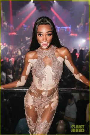 Winnie Harlow OnlyFans Leaked Free Thumbnail Picture - #5Hb4oQry7x