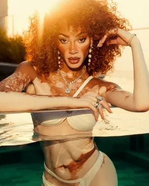 Winnie Harlow OnlyFans Leaked Free Thumbnail Picture - #5JstDGD2bE