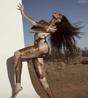 Winnie Harlow OnlyFans Leaked Free Thumbnail Picture - #5fxRkT82sl