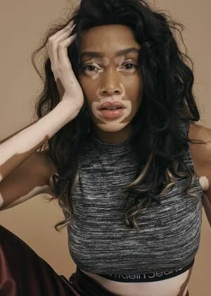 Winnie Harlow OnlyFans Leaked Free Thumbnail Picture - #5nqezcIgkQ