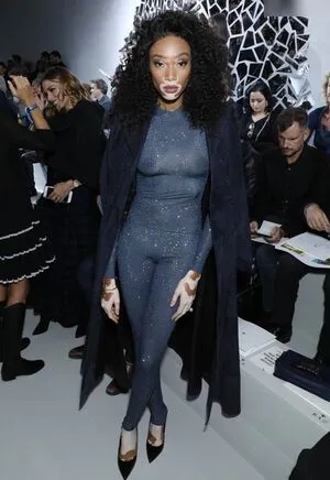Winnie Harlow OnlyFans Leaked Free Thumbnail Picture - #5rX7AH48cH