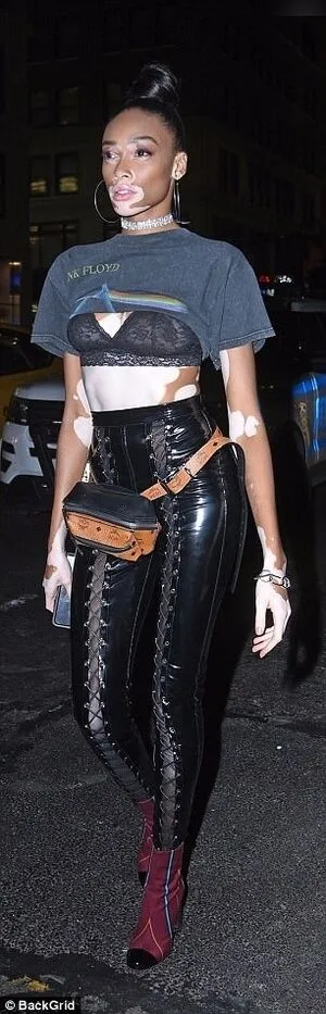 Winnie Harlow OnlyFans Leaked Free Thumbnail Picture - #60su9c5BED