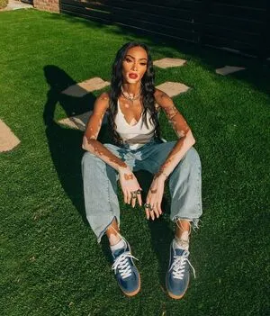 Winnie Harlow OnlyFans Leaked Free Thumbnail Picture - #62MwJMztkf