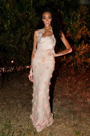 Winnie Harlow OnlyFans Leaked Free Thumbnail Picture - #64kSToRrrg