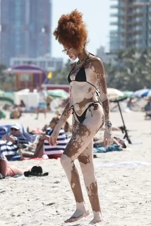 Winnie Harlow OnlyFans Leaked Free Thumbnail Picture - #694mkBYRrY
