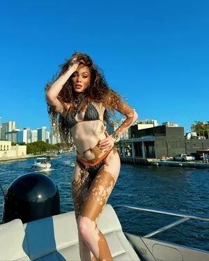 Winnie Harlow OnlyFans Leaked Free Thumbnail Picture - #6ECVMes8WD