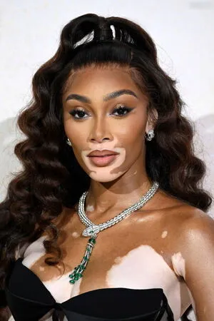 Winnie Harlow OnlyFans Leaked Free Thumbnail Picture - #6FpQdflZ4a