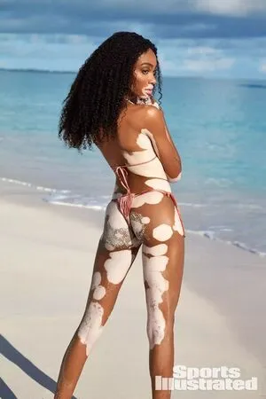 Winnie Harlow OnlyFans Leaked Free Thumbnail Picture - #6mV3DOcNw9
