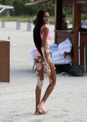 Winnie Harlow OnlyFans Leaked Free Thumbnail Picture - #6s6Y9Wwoch