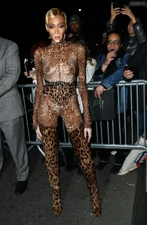 Winnie Harlow OnlyFans Leaked Free Thumbnail Picture - #72C28jsbrg