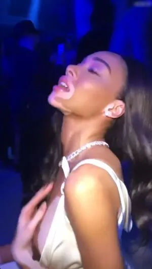 Winnie Harlow OnlyFans Leaked Free Thumbnail Picture - #793erreAue