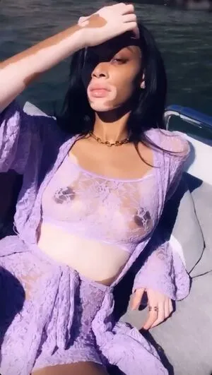 Winnie Harlow OnlyFans Leaked Free Thumbnail Picture - #7fQiiltg04