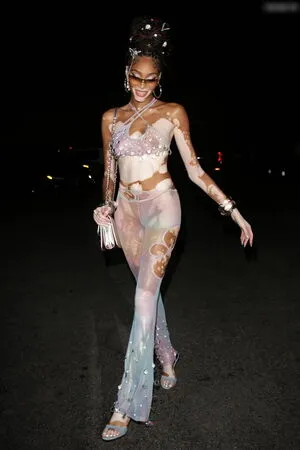 Winnie Harlow OnlyFans Leaked Free Thumbnail Picture - #7xUFbsPET5