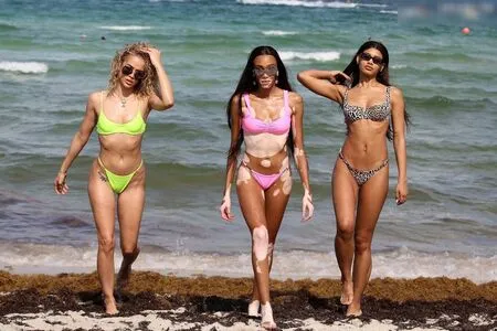 Winnie Harlow OnlyFans Leaked Free Thumbnail Picture - #89dL5DdZEV