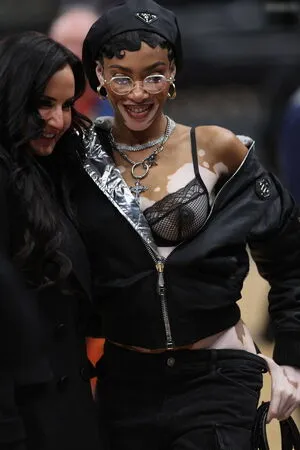 Winnie Harlow OnlyFans Leaked Free Thumbnail Picture - #89xrPpxw7j