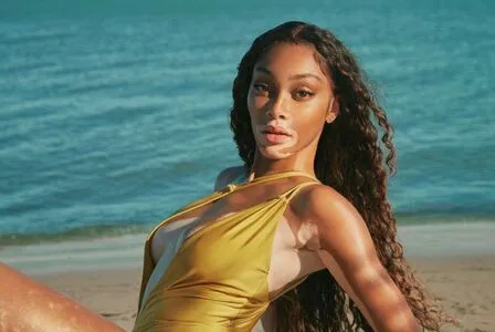 Winnie Harlow OnlyFans Leaked Free Thumbnail Picture - #8BJaaOr688