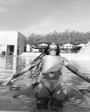 Winnie Harlow OnlyFans Leaked Free Thumbnail Picture - #8FkD6h5JVS