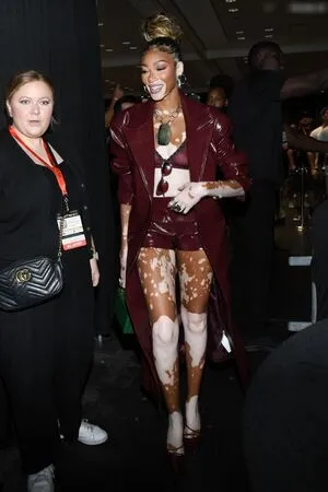 Winnie Harlow OnlyFans Leaked Free Thumbnail Picture - #8MyAXAn3WW