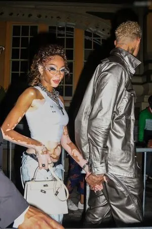 Winnie Harlow OnlyFans Leaked Free Thumbnail Picture - #8wPbtsynFp