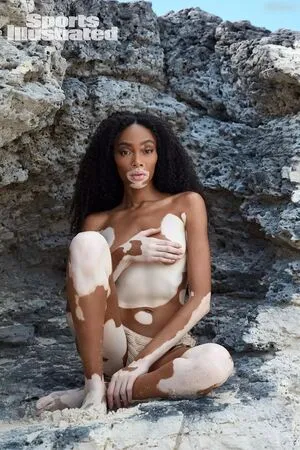 Winnie Harlow OnlyFans Leaked Free Thumbnail Picture - #9onZThleaw