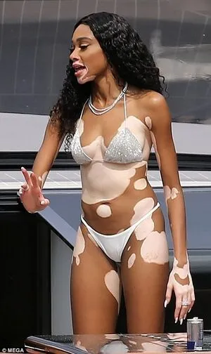 Winnie Harlow OnlyFans Leaked Free Thumbnail Picture - #AtEcXYso1n