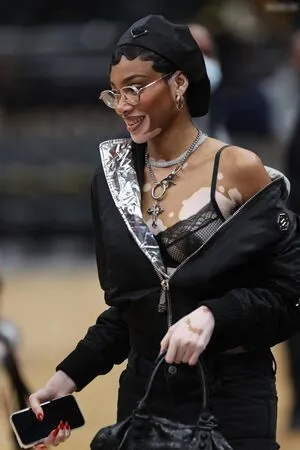 Winnie Harlow OnlyFans Leaked Free Thumbnail Picture - #C3UCMxJSp0