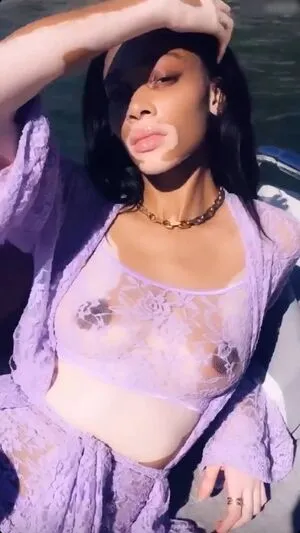 Winnie Harlow OnlyFans Leaked Free Thumbnail Picture - #CZHcaKjr2D