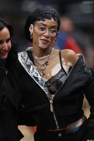 Winnie Harlow OnlyFans Leaked Free Thumbnail Picture - #CmUtCiotsu