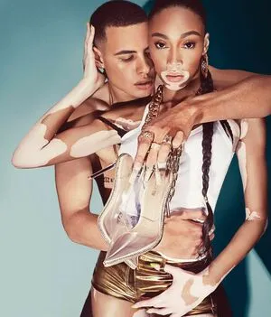 Winnie Harlow OnlyFans Leaked Free Thumbnail Picture - #Cr3p2EfsjJ