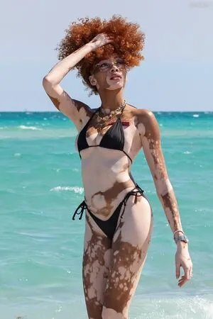 Winnie Harlow OnlyFans Leaked Free Thumbnail Picture - #DPfzEFCwjO