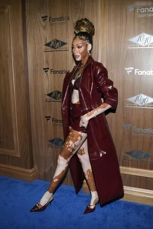 Winnie Harlow OnlyFans Leaked Free Thumbnail Picture - #DgJdA2Jl8C