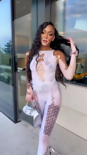 Winnie Harlow OnlyFans Leaked Free Thumbnail Picture - #EM1AXGN0az