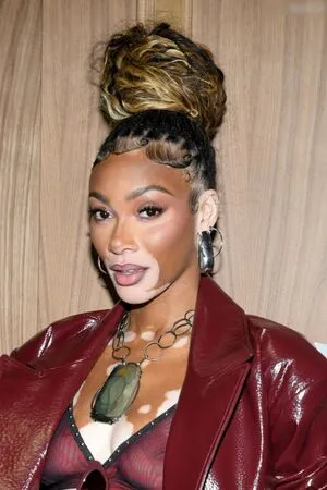 Winnie Harlow OnlyFans Leaked Free Thumbnail Picture - #EVrRfbwIar