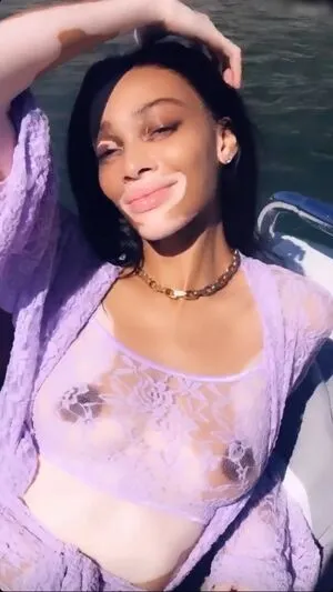 Winnie Harlow OnlyFans Leaked Free Thumbnail Picture - #EwtqKEBnK9
