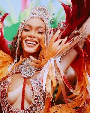 Winnie Harlow OnlyFans Leaked Free Thumbnail Picture - #FCBVHYaEXo
