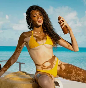 Winnie Harlow OnlyFans Leaked Free Thumbnail Picture - #GLJP055Bcj