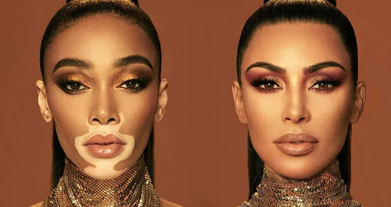 Winnie Harlow OnlyFans Leaked Free Thumbnail Picture - #I8g7yC2GS0