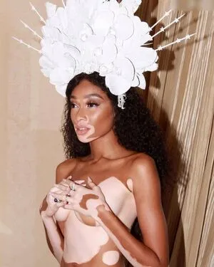 Winnie Harlow OnlyFans Leaked Free Thumbnail Picture - #IOoFuTIy1F