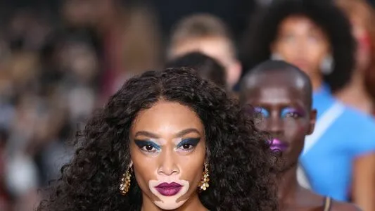 Winnie Harlow OnlyFans Leaked Free Thumbnail Picture - #J6UYHBecAQ