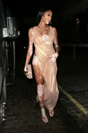 Winnie Harlow OnlyFans Leaked Free Thumbnail Picture - #JDE6kIRjTd