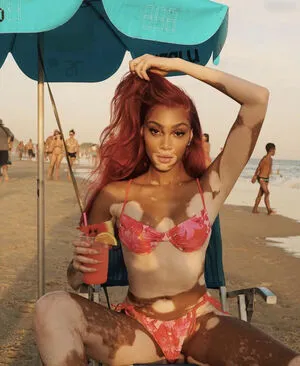 Winnie Harlow OnlyFans Leaked Free Thumbnail Picture - #JIUnLalGYC